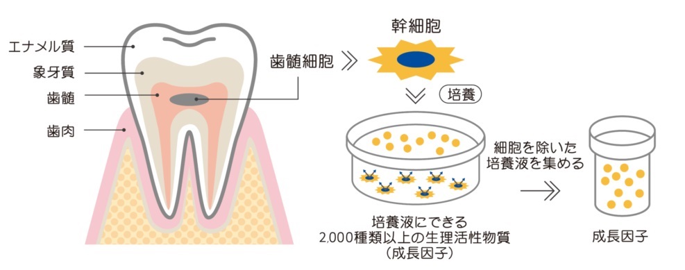 ヒト乳歯歯髄幹細胞培養上清液が作られる過程